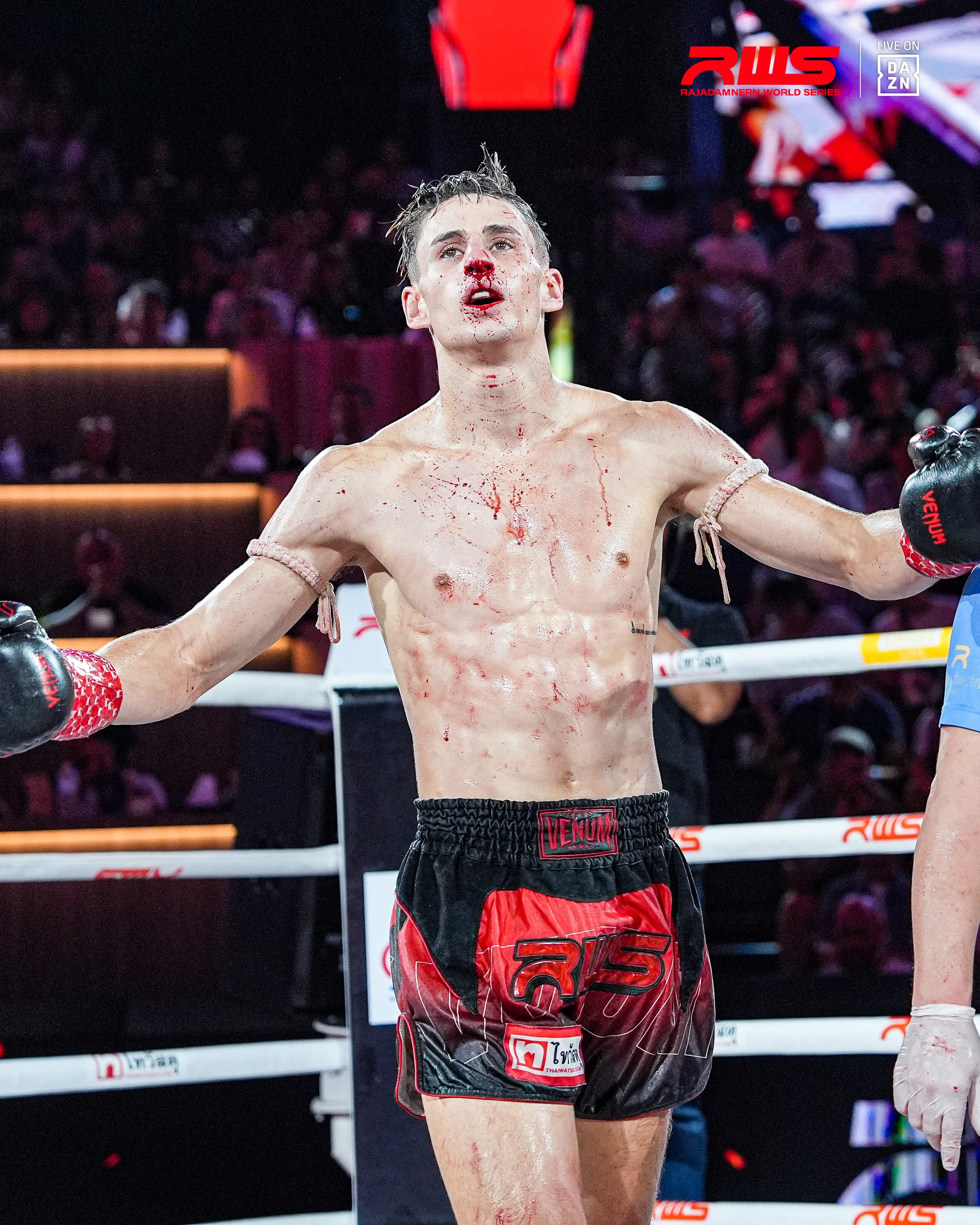 Bloodied but composed, Louie Doherty stands against the ropes mid-fight
